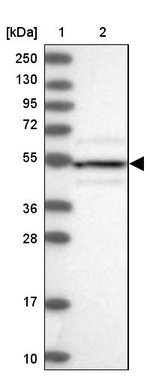 DRAK1 Antibody in Western Blot (WB)