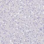 Carboxypeptidase B1 Antibody in Immunohistochemistry (Paraffin) (IHC (P))
