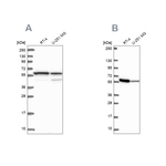 MCCC2 Antibody in Western Blot (WB)