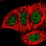 FANK1 Polyclonal Antibody