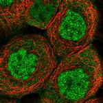 ELMOD1 Polyclonal Antibody