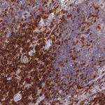 CD3g Antibody in Immunohistochemistry (Paraffin) (IHC (P))