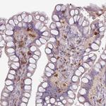 CD3g Antibody in Immunohistochemistry (Paraffin) (IHC (P))
