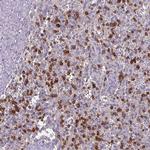 CD3g Antibody in Immunohistochemistry (Paraffin) (IHC (P))