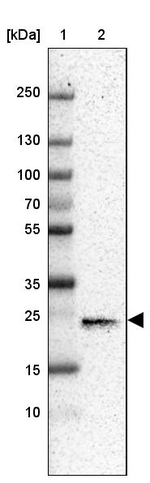 CD3g Antibody in Western Blot (WB)