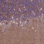GPR63 Antibody in Immunohistochemistry (Paraffin) (IHC (P))