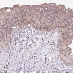 TPT1 Antibody in Immunohistochemistry (Paraffin) (IHC (P))