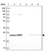 TPT1 Antibody in Western Blot (WB)