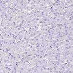 EPCR Antibody in Immunohistochemistry (Paraffin) (IHC (P))
