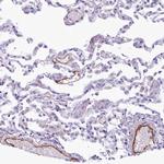 EPCR Antibody in Immunohistochemistry (Paraffin) (IHC (P))
