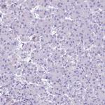 EPCR Polyclonal Antibody