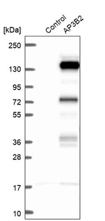 AP3B2 Antibody in Western Blot (WB)