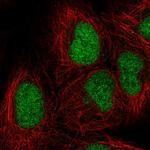 ORC3 Polyclonal Antibody