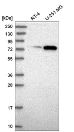 ORC3 Antibody in Western Blot (WB)