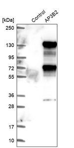 AP3B2 Antibody in Western Blot (WB)