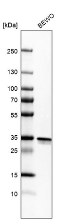 REA Antibody in Western Blot (WB)