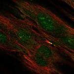 TMEM117 Polyclonal Antibody