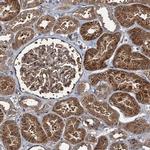 RhoBTB1 Polyclonal Antibody