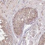 ACVR2B Antibody in Immunohistochemistry (Paraffin) (IHC (P))