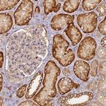 M6PR Polyclonal Antibody