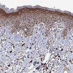 NEK8 Antibody in Immunohistochemistry (Paraffin) (IHC (P))