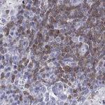 CD3e Antibody in Immunohistochemistry (Paraffin) (IHC (P))