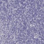 CD3e Antibody in Immunohistochemistry (Paraffin) (IHC (P))