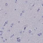 CD3e Antibody in Immunohistochemistry (Paraffin) (IHC (P))