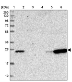 CD3e Antibody in Western Blot (WB)