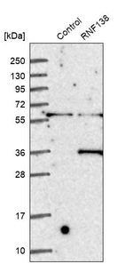 RNF138 Antibody in Western Blot (WB)