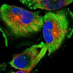 FAM45A Polyclonal Antibody