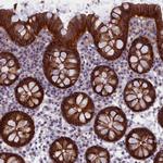TRPM4 Antibody in Immunohistochemistry (Paraffin) (IHC (P))