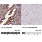 TRPM4 Antibody in Immunohistochemistry (Paraffin) (IHC (P))