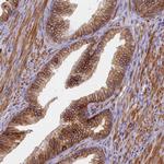 TRPM4 Antibody in Immunohistochemistry (Paraffin) (IHC (P))
