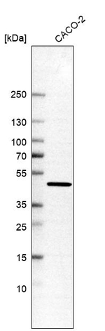 AHCY Antibody in Western Blot (WB)