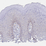 PRDX3 Antibody in Immunohistochemistry (Paraffin) (IHC (P))