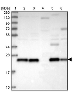 PRDX3 Antibody in Western Blot (WB)