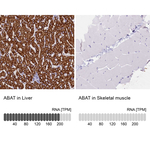 ABAT Antibody in Immunohistochemistry (Paraffin) (IHC (P))