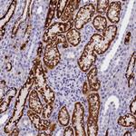 ABAT Antibody in Immunohistochemistry (Paraffin) (IHC (P))