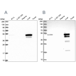 ABAT Antibody in Western Blot (WB)