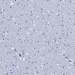 LYPD3 Antibody in Immunohistochemistry (Paraffin) (IHC (P))