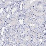 LYPD3 Antibody in Immunohistochemistry (Paraffin) (IHC (P))