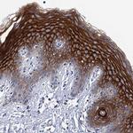 LYPD3 Antibody in Immunohistochemistry (Paraffin) (IHC (P))