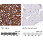 ABAT Antibody in Immunohistochemistry (Paraffin) (IHC (P))