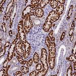 ABAT Antibody in Immunohistochemistry (Paraffin) (IHC (P))