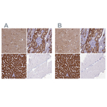 ABAT Polyclonal Antibody