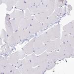 ABAT Antibody in Immunohistochemistry (Paraffin) (IHC (P))