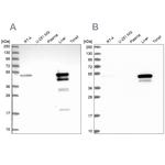 ABAT Antibody in Western Blot (WB)