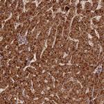 Coronin 3 Polyclonal Antibody