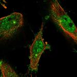 LMTK2 Polyclonal Antibody